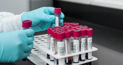 Wywołują Zapalenie Wątroby. Wy...