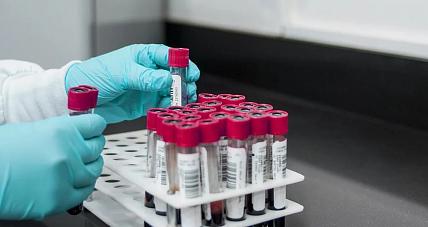 Polscy Naukowcy Wyizolowali...